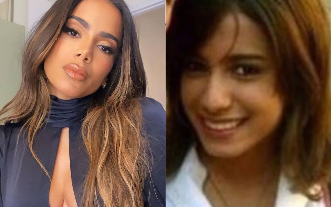 Anitta Orgullosa Del Rostro Que Se Construyó Antes Y Después De Las Cirugías Diario De Xalapa